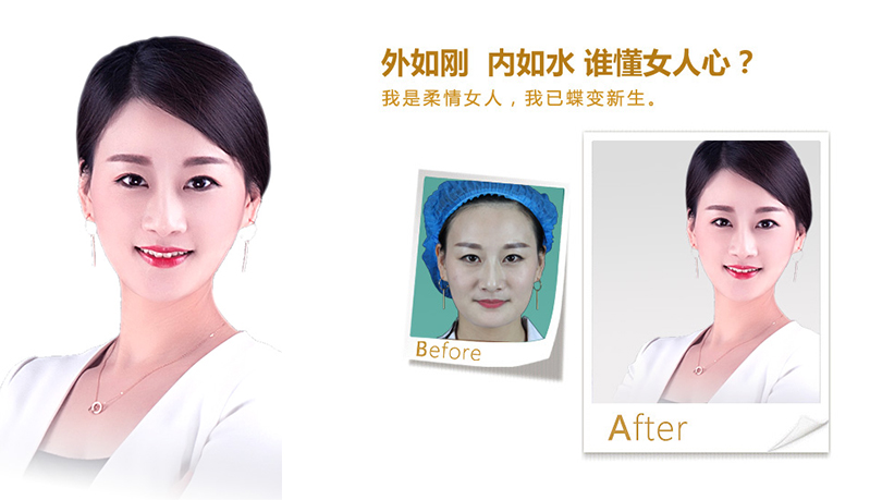 连云港V脸、线雕隆鼻